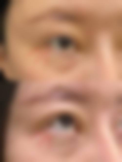 西宁澳丽医疗整形美容医院特色项目及技术优势