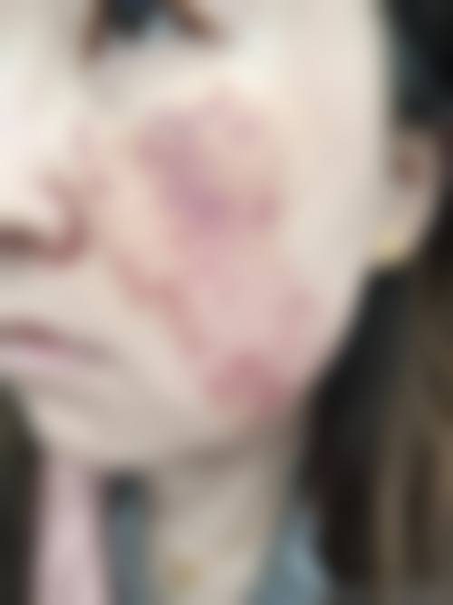 双鸭山孙力整形医疗美容诊所价格收费