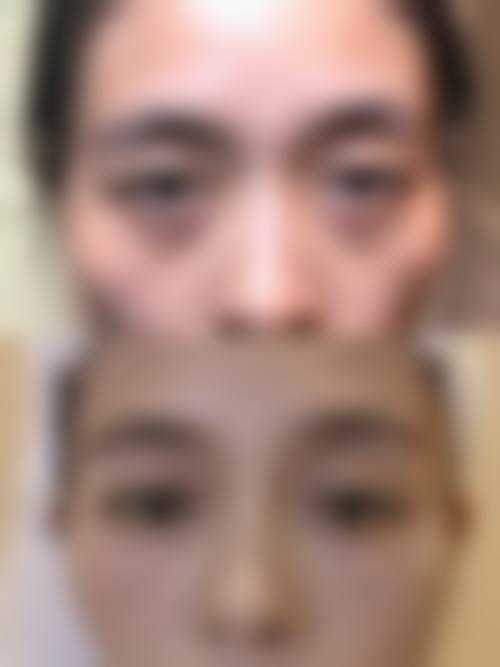 林祥医生坚持的个性化医美服务理念