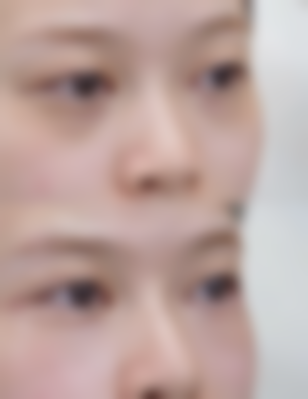 韩国LUX整形外科医院价格收费