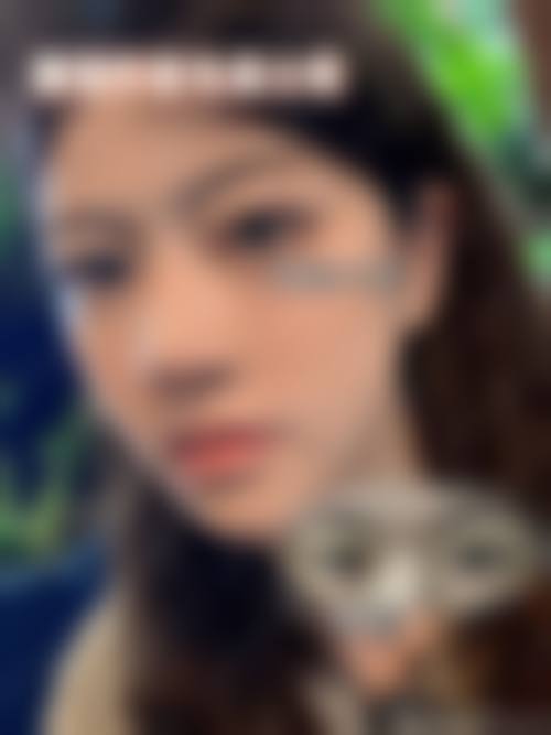 张家界瑞美整形医院求美者反馈