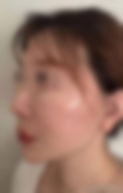 临海嘉美娜整形医院价格收费
