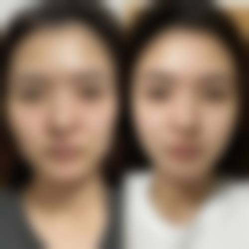 宁德洛妃整形医院价格收费