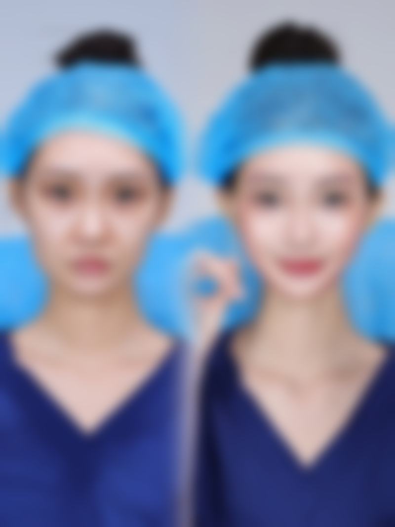 梅州皇佳贝丽整形医院求美者反馈