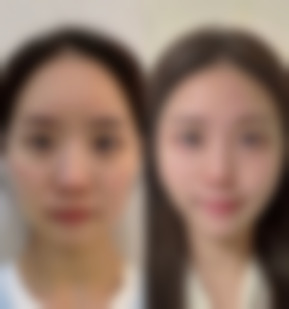 益阳爱思特整形医院求美者反馈