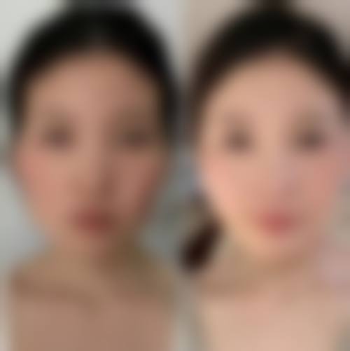 吕德华医生依托的专精医美平台实力