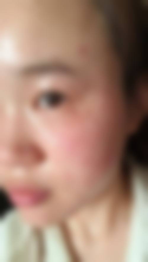 吕德华医生的精细化诊疗服务理念