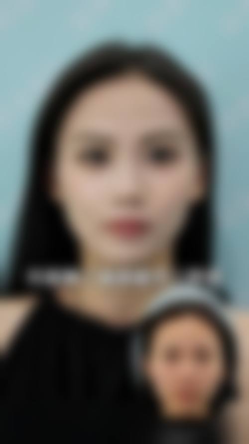 赤峰吕玲玲整形医院来院路线