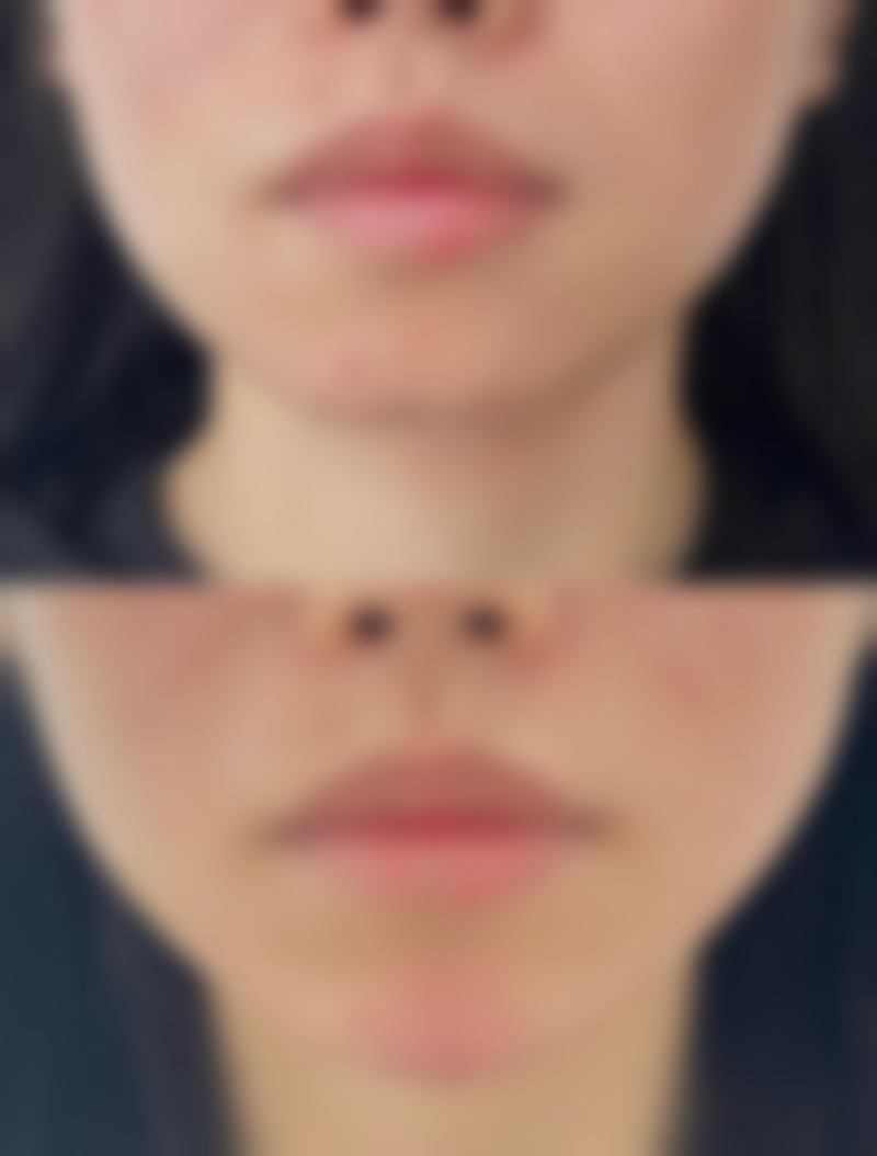 大连星悦医疗美容诊所价格收费