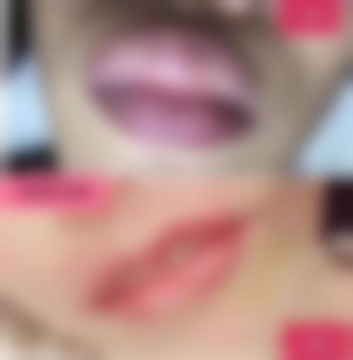 苏州维秘医疗美容诊所求美者反馈