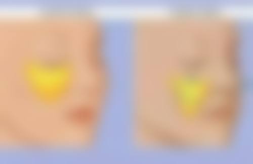 苏州维秘医疗美容诊所特色项目及技术优势