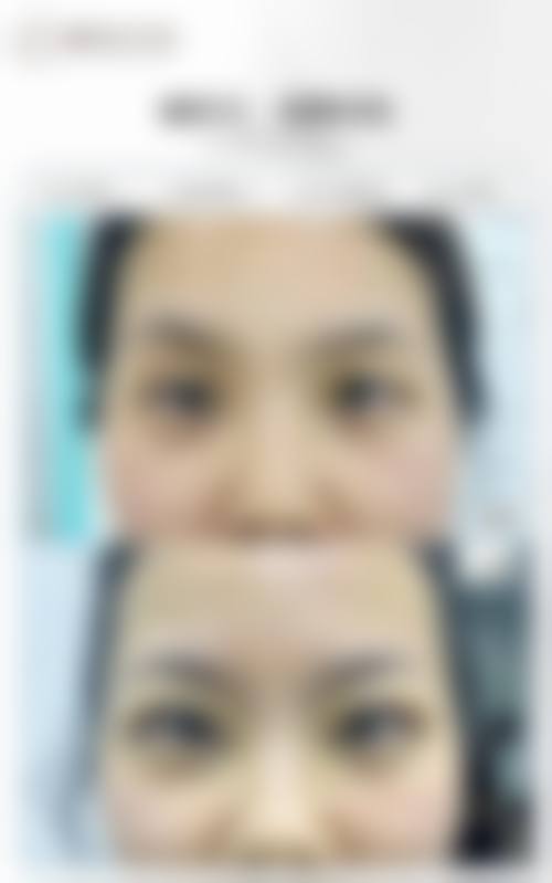 杭州西美医疗美容医院求美者反馈