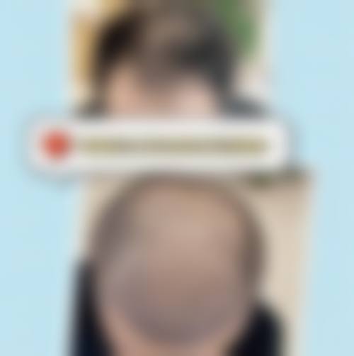 赵金凤擅长的核心医美项目
