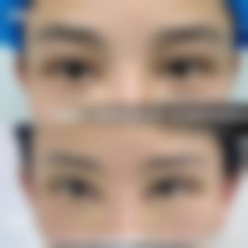 泸州华艺整形医院求美者反馈
