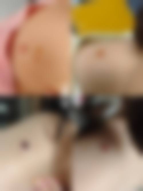 刘建章医生的特色项目与收费参考