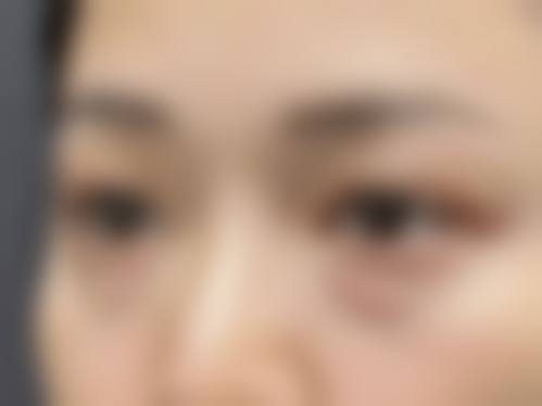 石家庄雅芳亚长征医疗美容诊所求美者反馈
