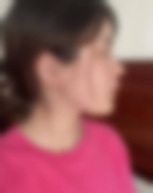 成都可思美医疗美容门诊部求美者反馈