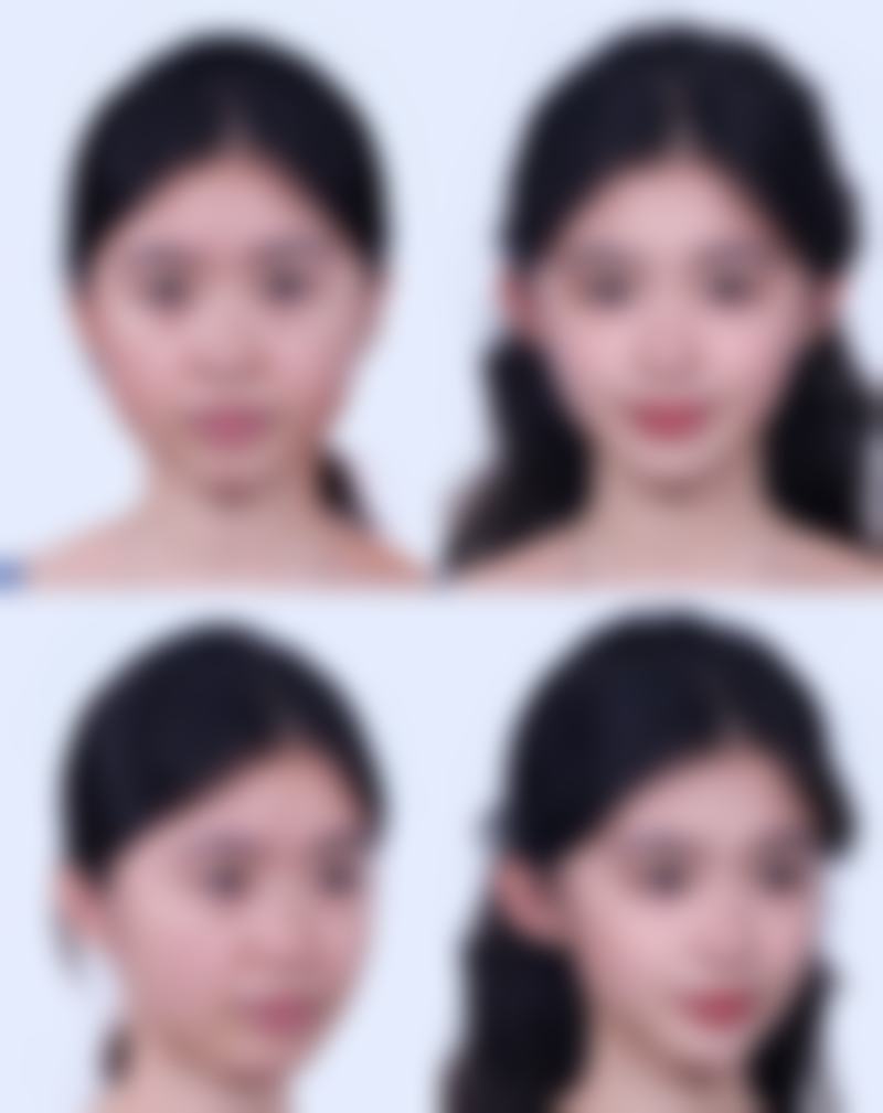 太原华美口腔美容中 心价格收费