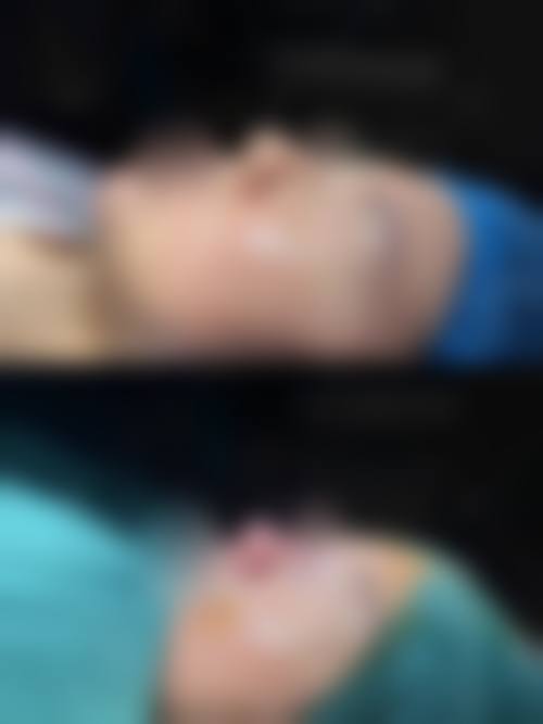 大连何医生鼻整形门诊部求美者反馈