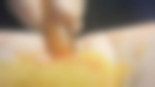 浏阳康美医疗美容门诊部求美者反馈