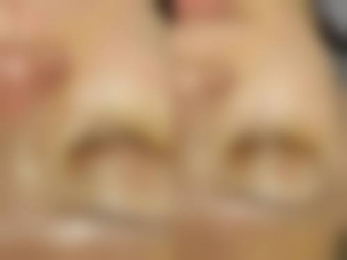 重庆星薏整形医院求美者反馈