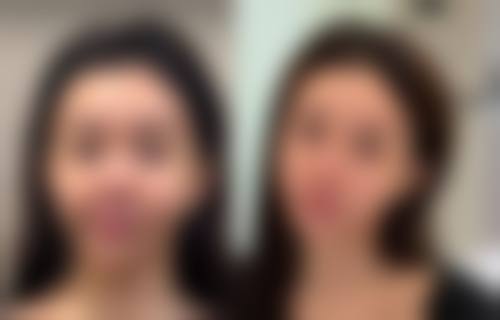 商丘轩大夫医疗美容诊所价格收费