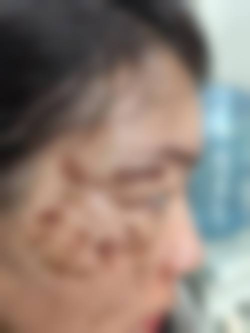 哈尔滨诺依嬄美整形医院价格收费