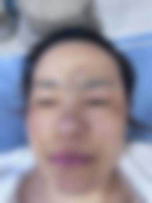 哈尔滨诺依嬄美整形医院特色项目及技术优势
