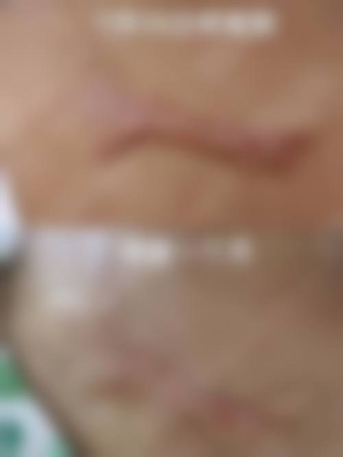 张少博医生坚持个性化定制诊疗方案