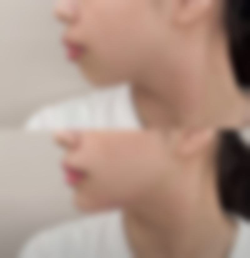 东莞莞城天后医疗美容门诊来院路线