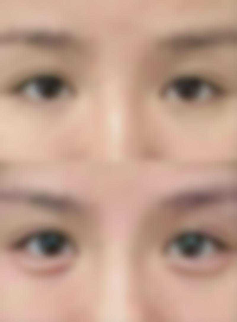 东莞莞城天后医疗美容门诊求美者反馈