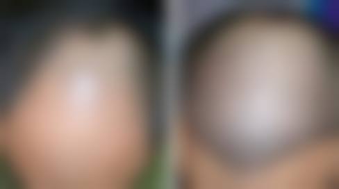 如何预约陈诚医师的面诊服务