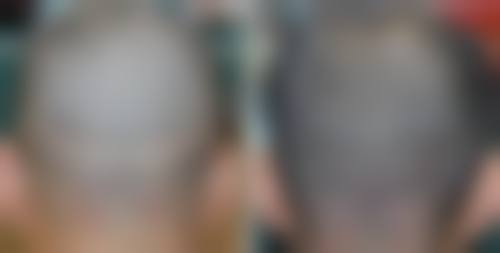 到院选择曹丽诊疗的相关指引
