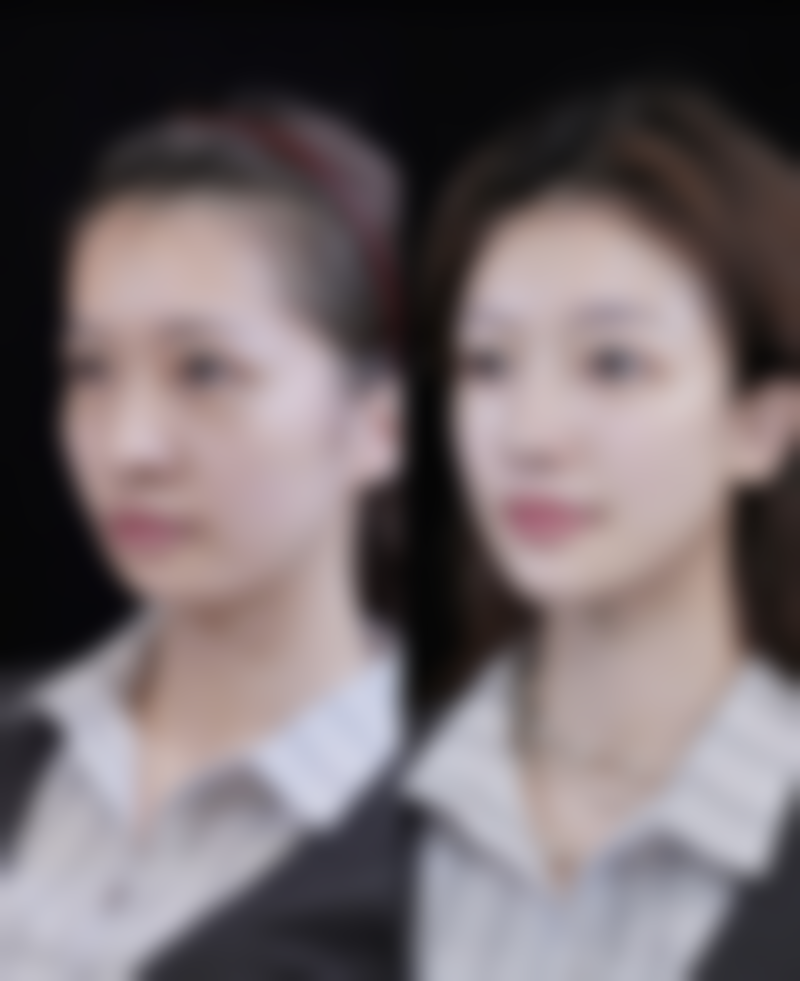 潍坊韩奈姿整形医院求美者反馈