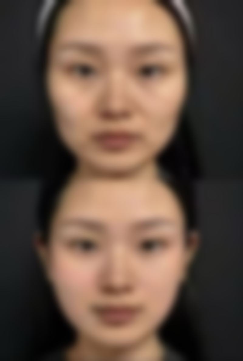华韩（海南）整形美容医院有限公司价格收费