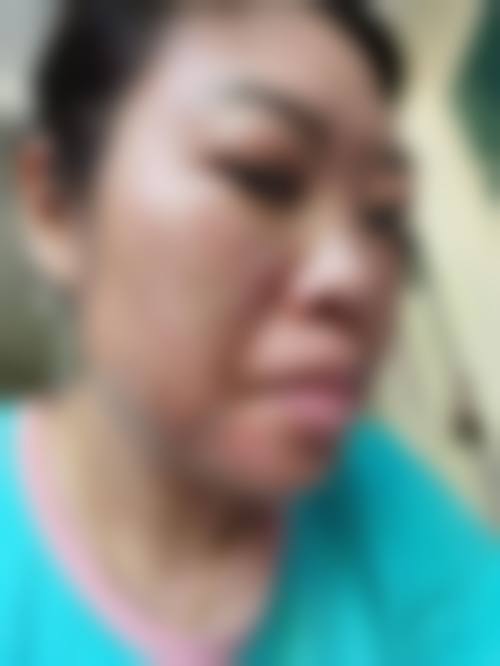 朱喆辰医生坚守的安心医美服务理念