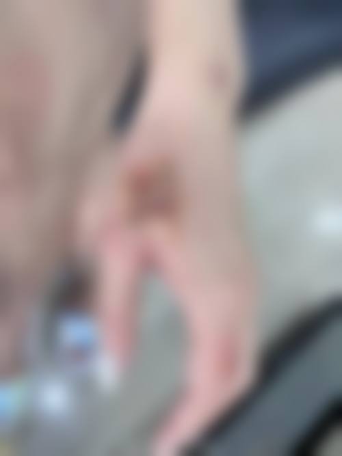 罗滨林医生可覆盖的医美诊疗项目