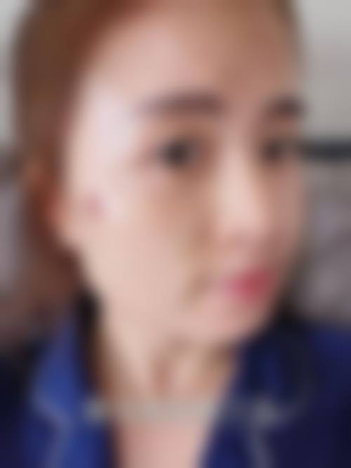 惠州心悦仁美医疗美容诊所求美者反馈
