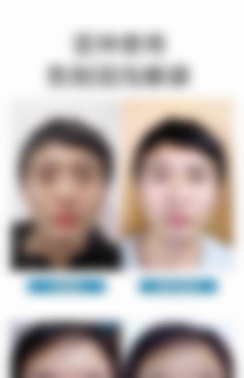 中山伊美神医疗美容整形医院特色项目及技术优势