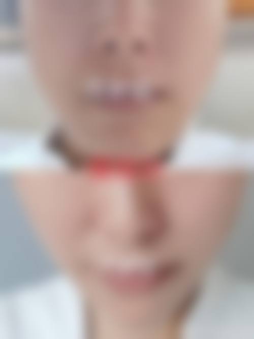 金升俊医生可操作鼻部与面部轮廓整形
