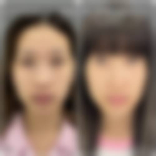 胡巨龙医生的个性化定制诊疗理念