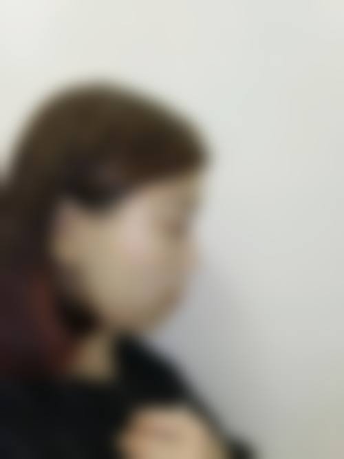 南京姬颜医疗美容诊所求美者反馈