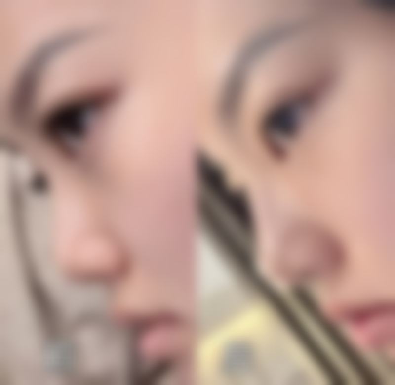 西昌芊妍维美整形医院价格收费