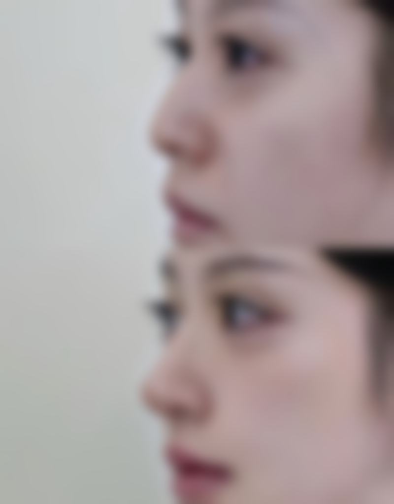 西昌芊妍维美整形医院求美者反馈