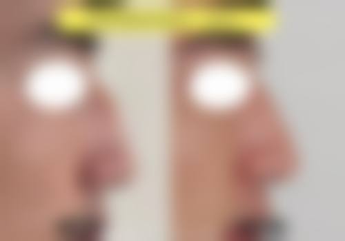 就诊指引与预约方式 便捷获取专精服务