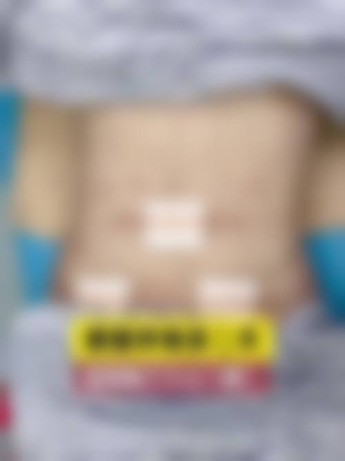 柯泽红医生可开展的全品类医美项目 满足多元变得更美需求
