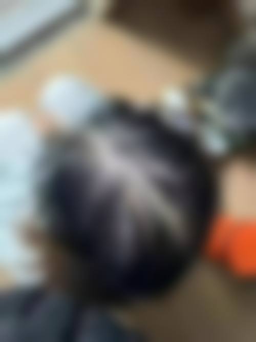 乌鲁木齐碧莲盛植发医疗美容诊所特色项目及技术优势
