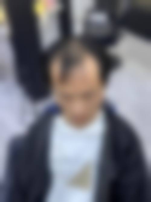 乌鲁木齐碧莲盛植发医疗美容诊所求美者反馈