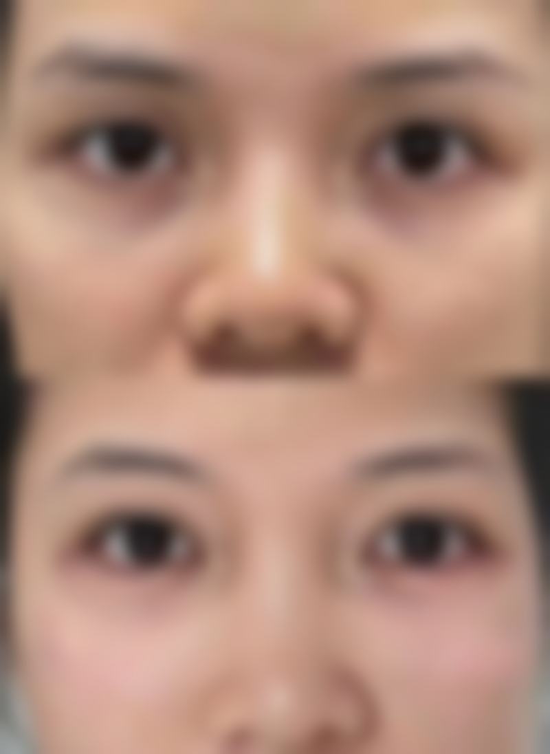 韩国釜山哈娜尔整形外科特色项目及技术优势