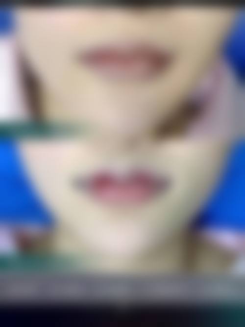 宁海魏天义医疗美容诊所价格收费